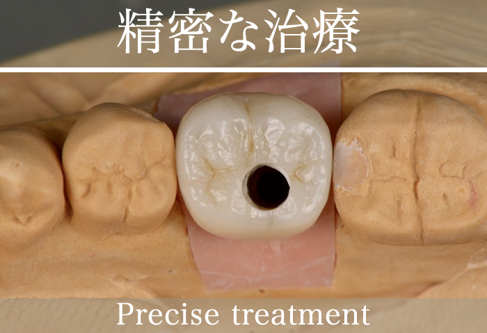 精密な治療